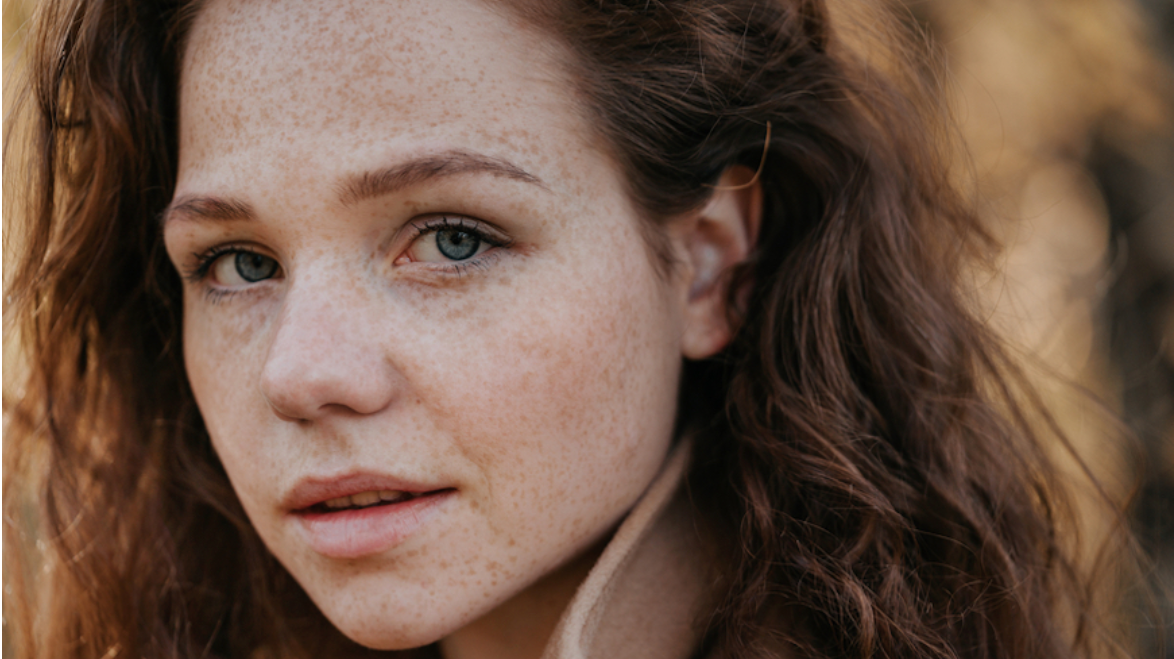 WELL + GOOD: I’M A FACIALIST, AND THIS IS THE MOST COMMON SKIN CONCERN I GET ASKED ABOUT