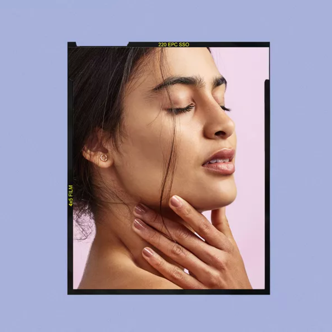 BYRDIE: Everything You Need To Know About Melasma, Straight From Derms