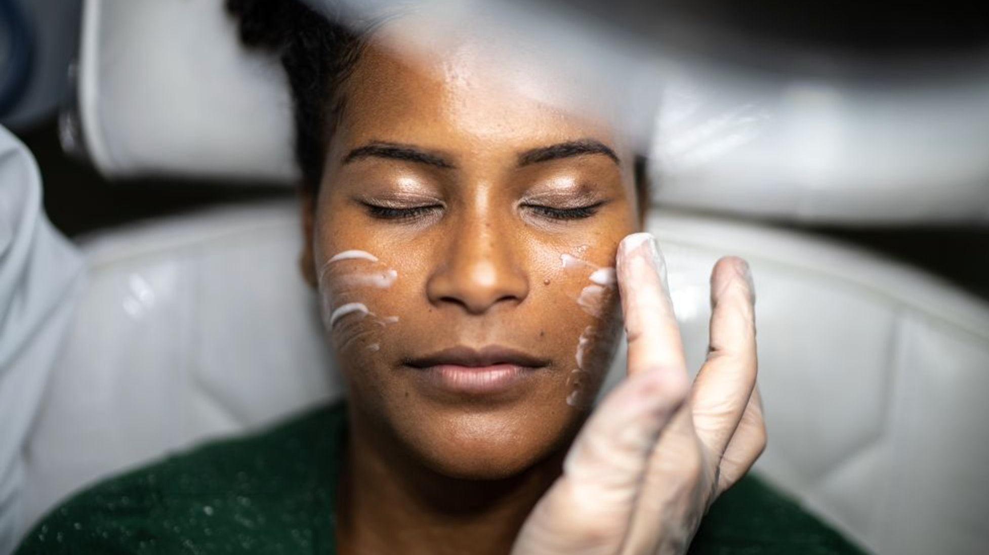 Women's Health: Here's What To Expect From A Glycolic Acid Peel, Say Experts