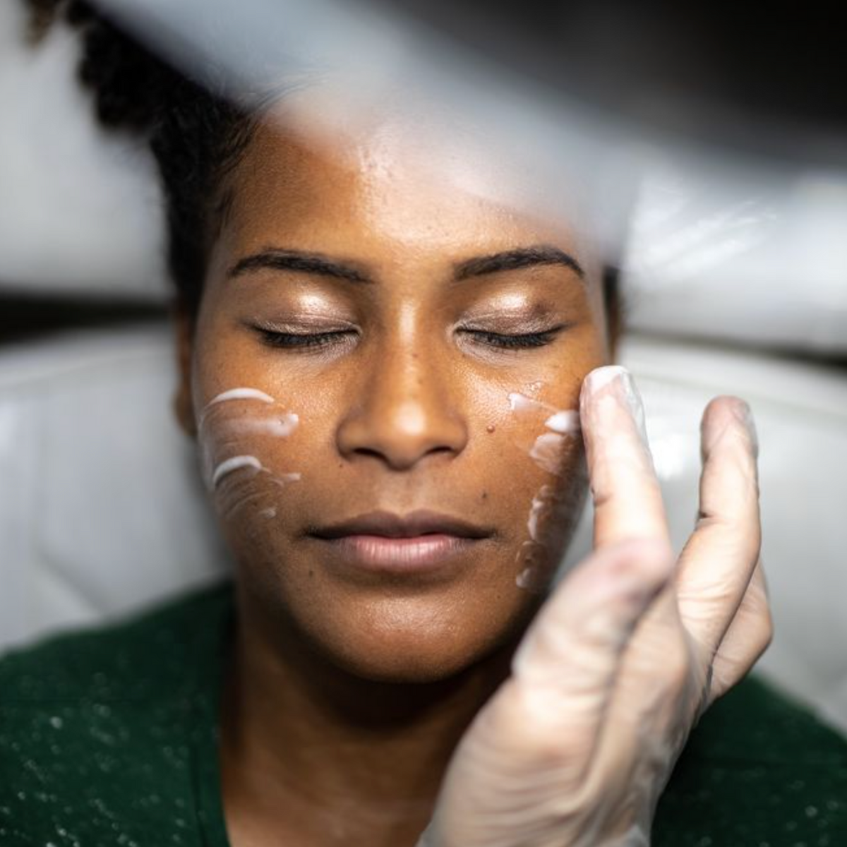Women's Health: Here's What To Expect From A Glycolic Acid Peel, Say Experts