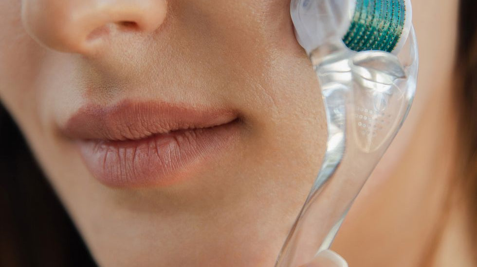 MARIE CLAIRE: What Is Dermarolling, and Is It Safe for My Skin?
