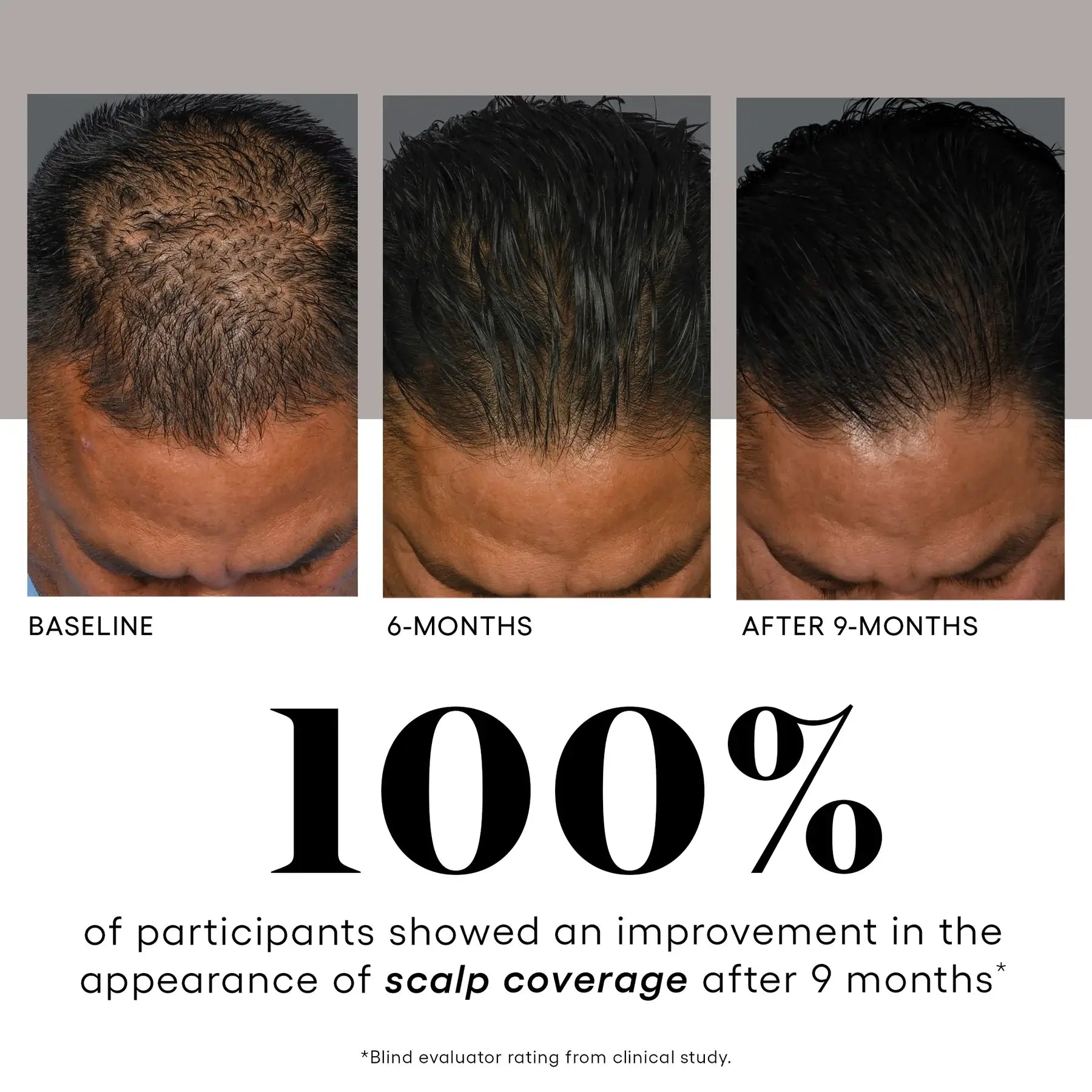 HAIR Serum by plated, view 4 of 12