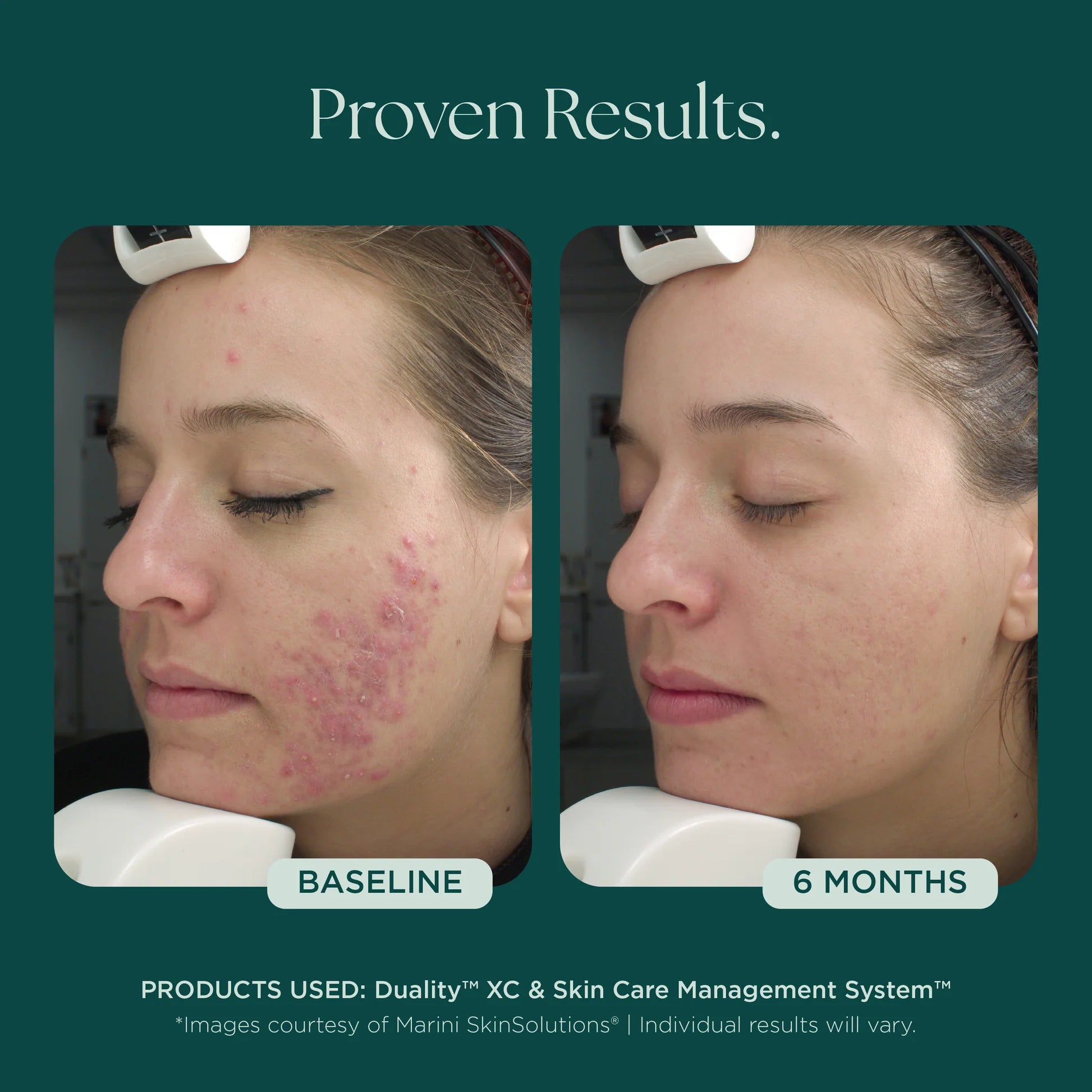 Duality XC by Marini SkinSolutions, view 3 of 7