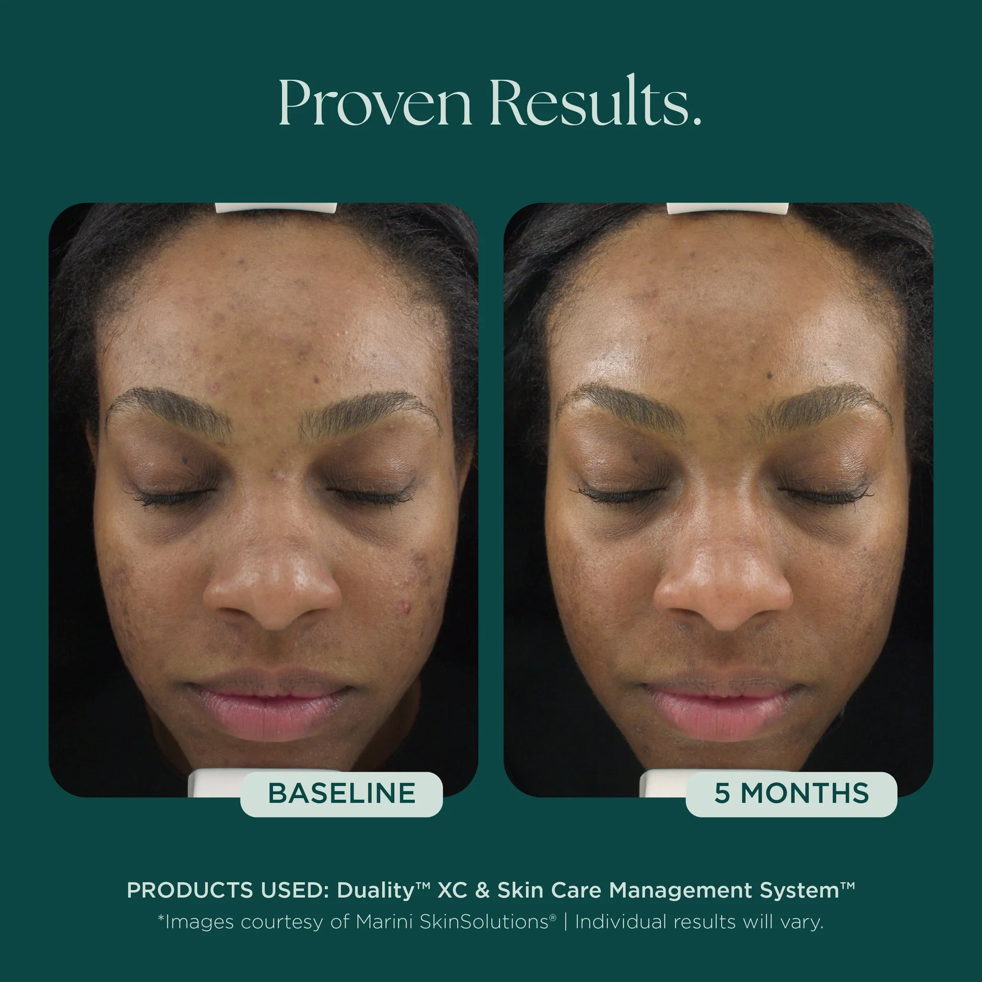 Duality XC by Marini SkinSolutions, view 4 of 7