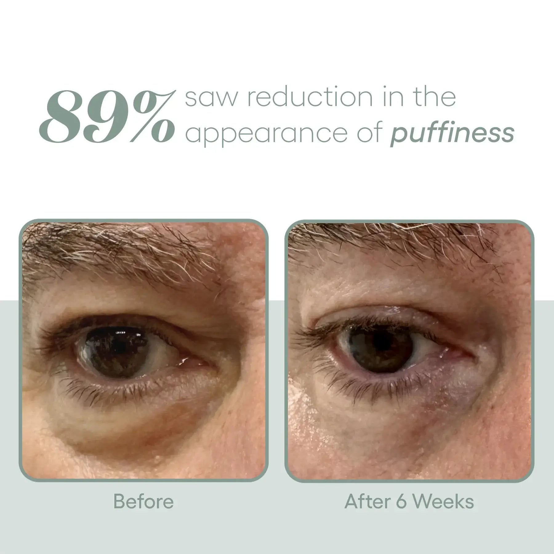 ( plated ) EYE Serum