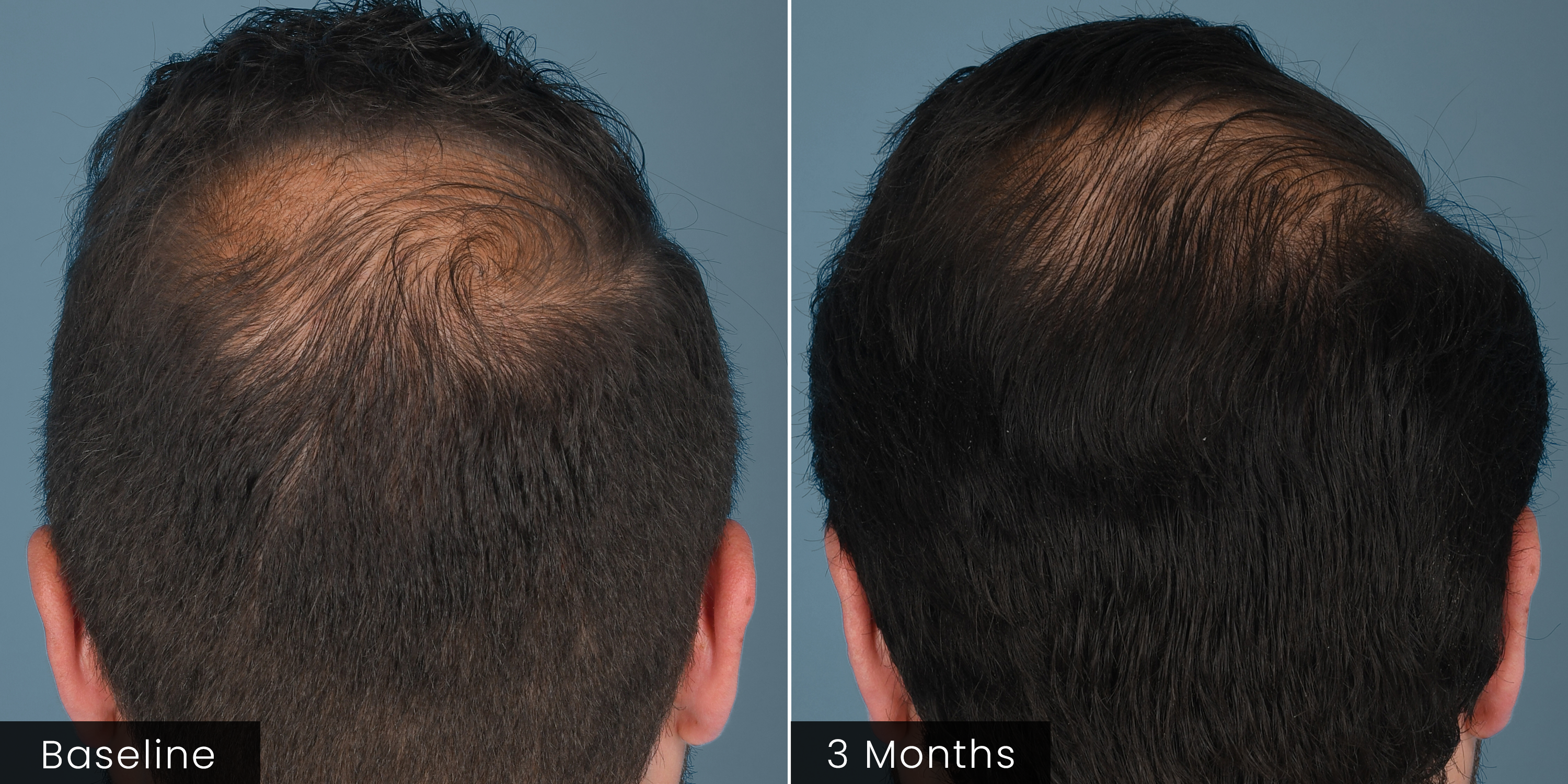 HAIR Serum by plated, view 11 of 12