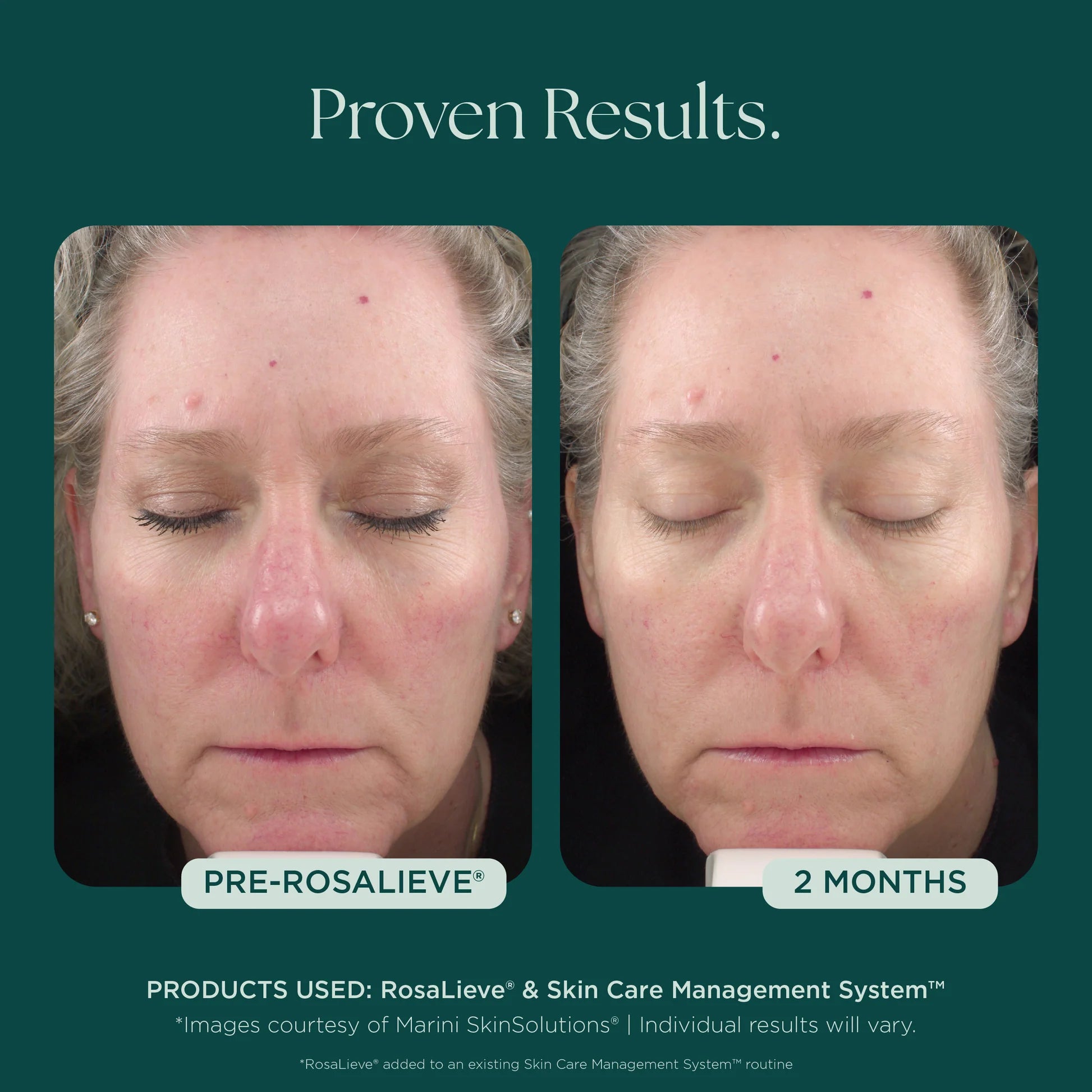 RosaLieve Redness Reducing Complex by Marini SkinSolutions, serum from the Marini SkinSolutions range