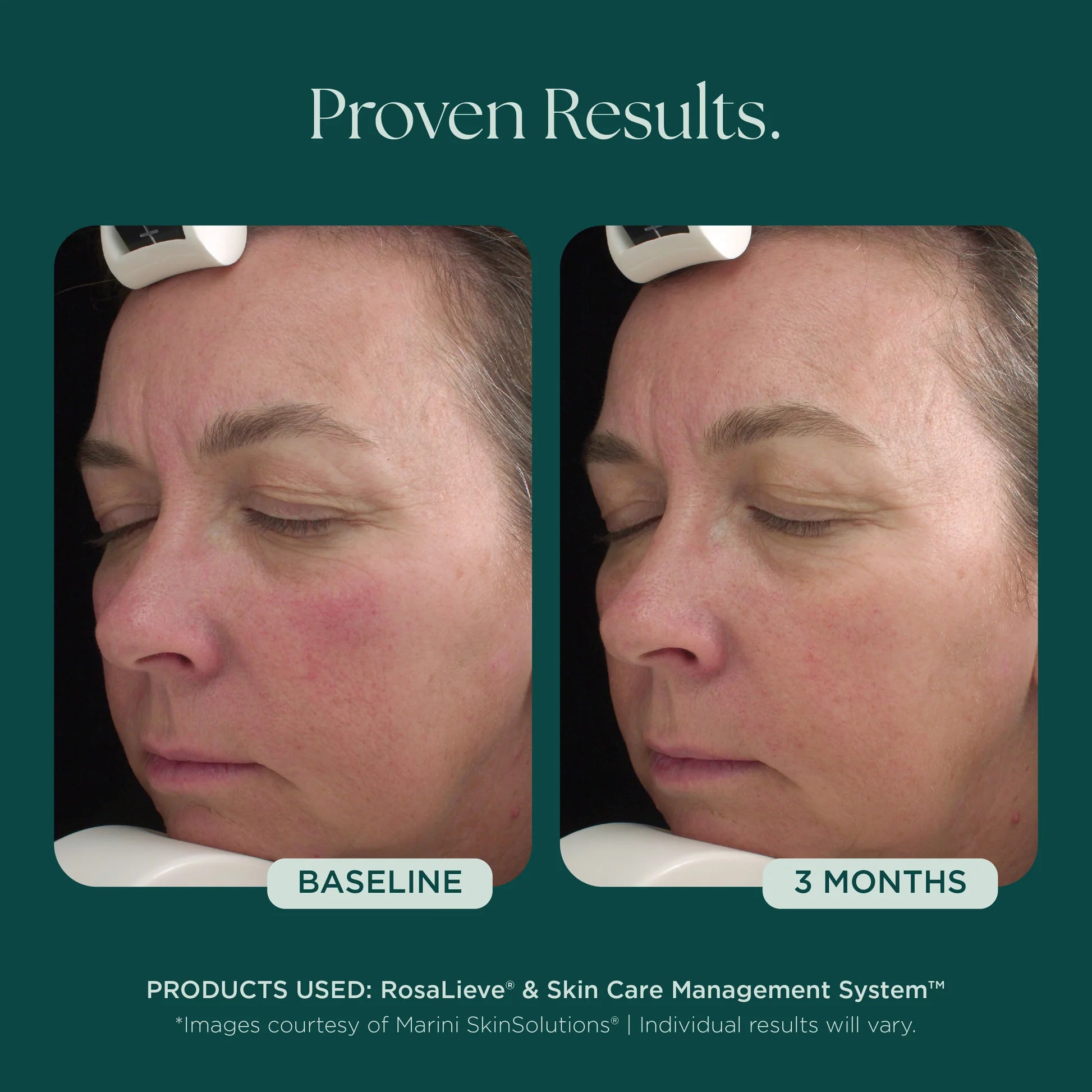 RosaLieve Redness Reducing Complex by Marini SkinSolutions, serum, additional product image