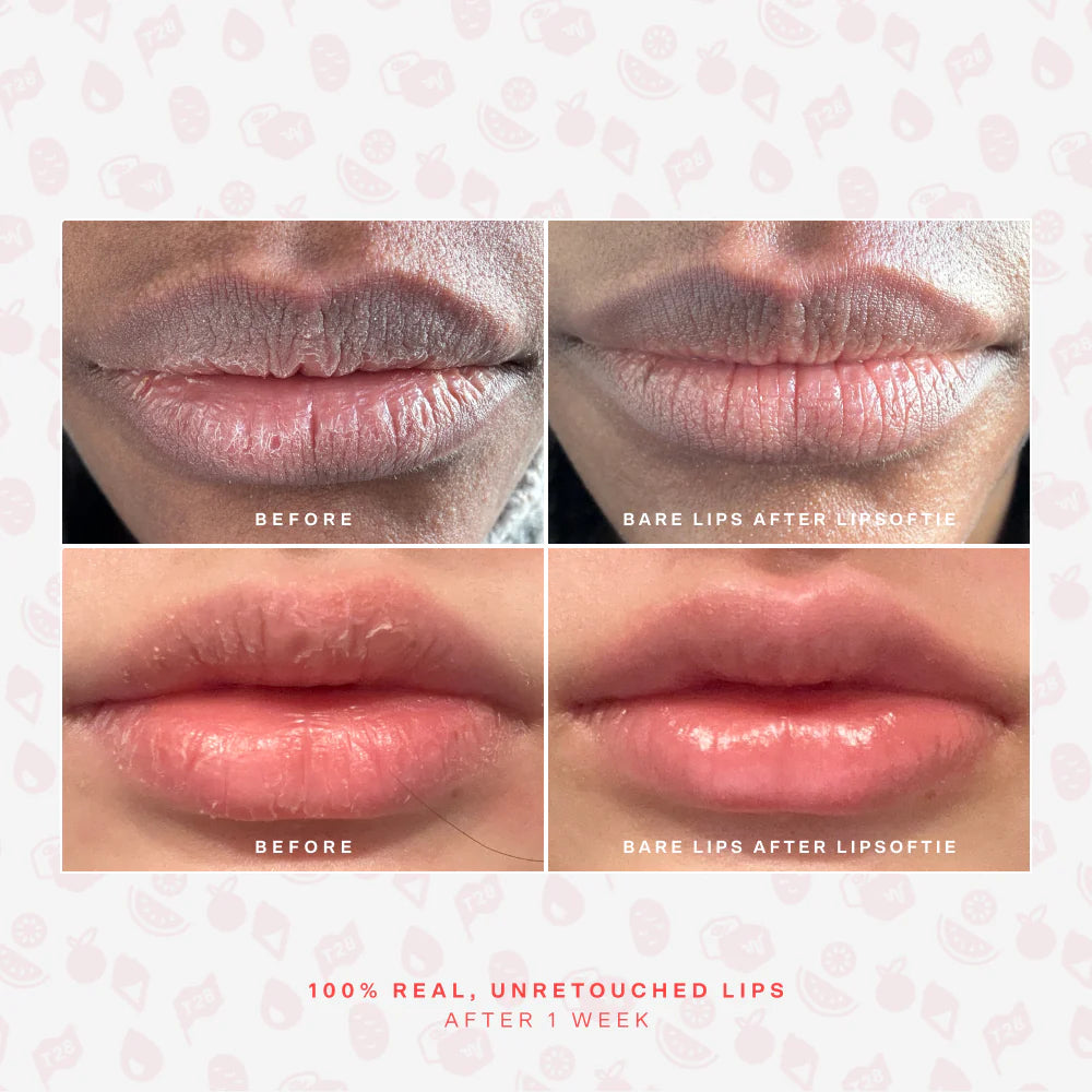 Before and after using SOS LipSoftie Lip Treatment overnight as a lip mask