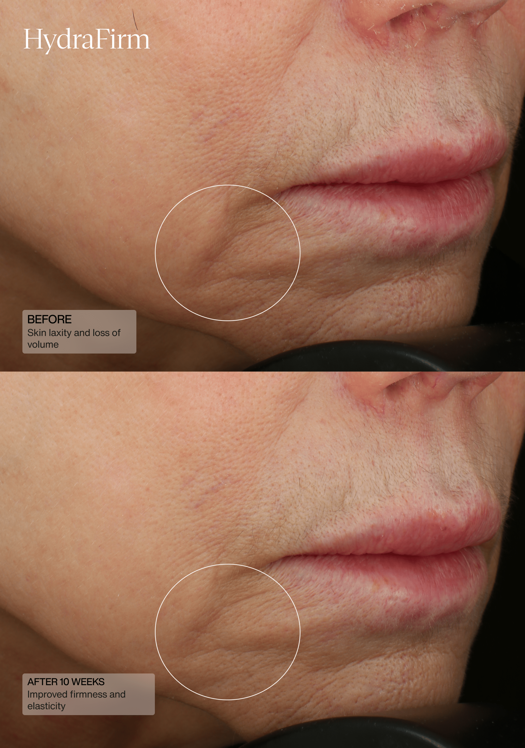 HydraFirm Serum by Senté, in use