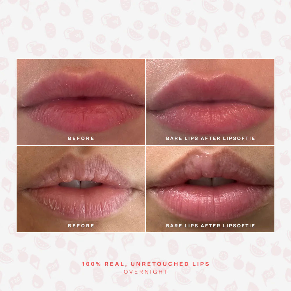 Clinical results for Tower 28 SOS LipSoftie Lip Treatment