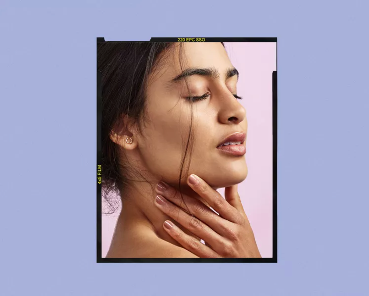 BYRDIE: Everything You Need To Know About Melasma, Straight From Derms