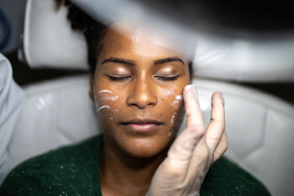 Women's Health: Here's What To Expect From A Glycolic Acid Peel, Say Experts