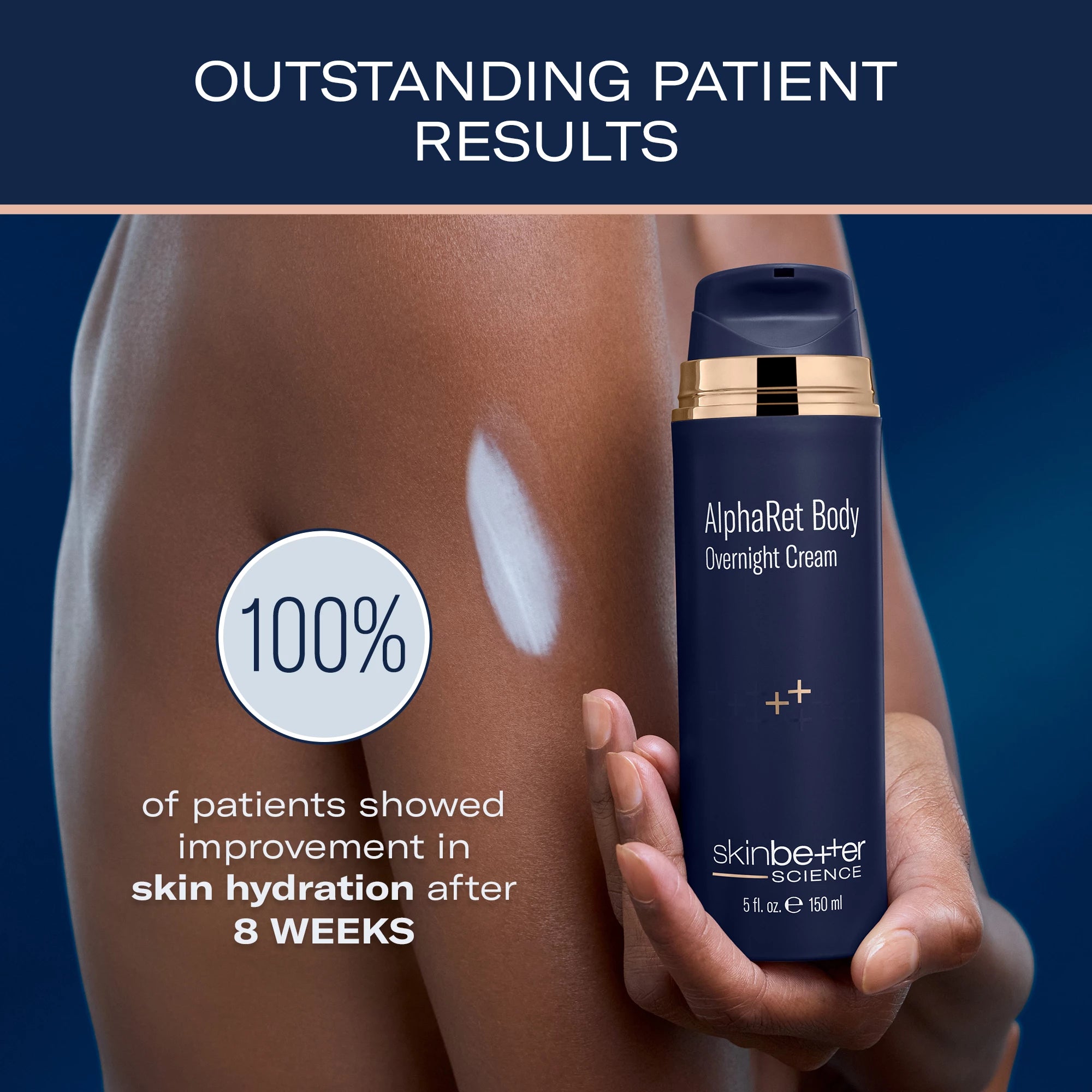 AlphaRet Body Overnight Cream with model