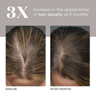 HAIR Serum by plated, view 5 of 12