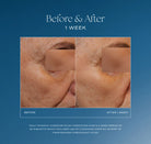Daily Dynamic Hydrator by iS Clinical, view 5 of 8