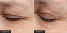 ( plated ) EYE Serum before and after results
