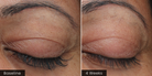 ( plated ) EYE Serum before and after results