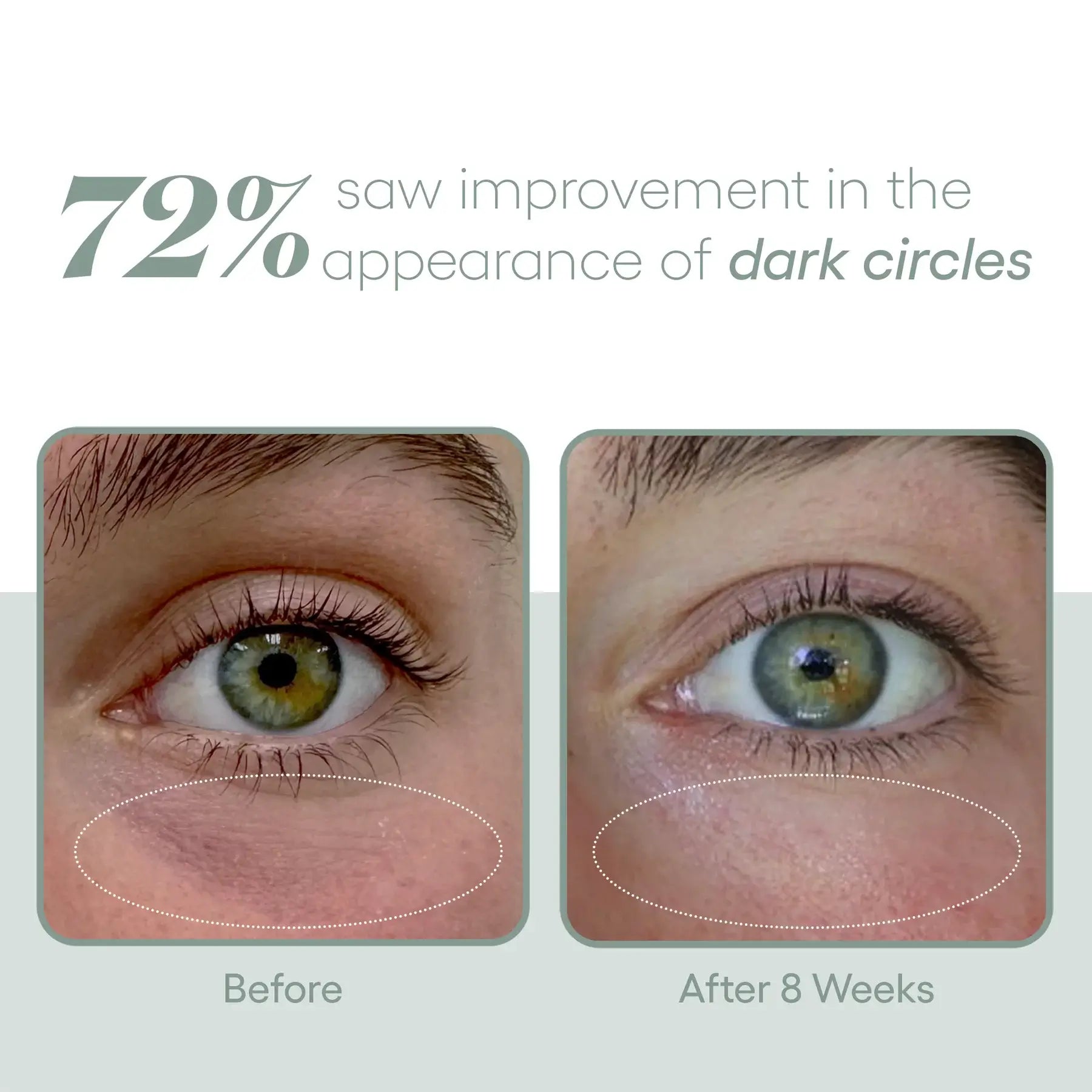 ( plated ) EYE Serum