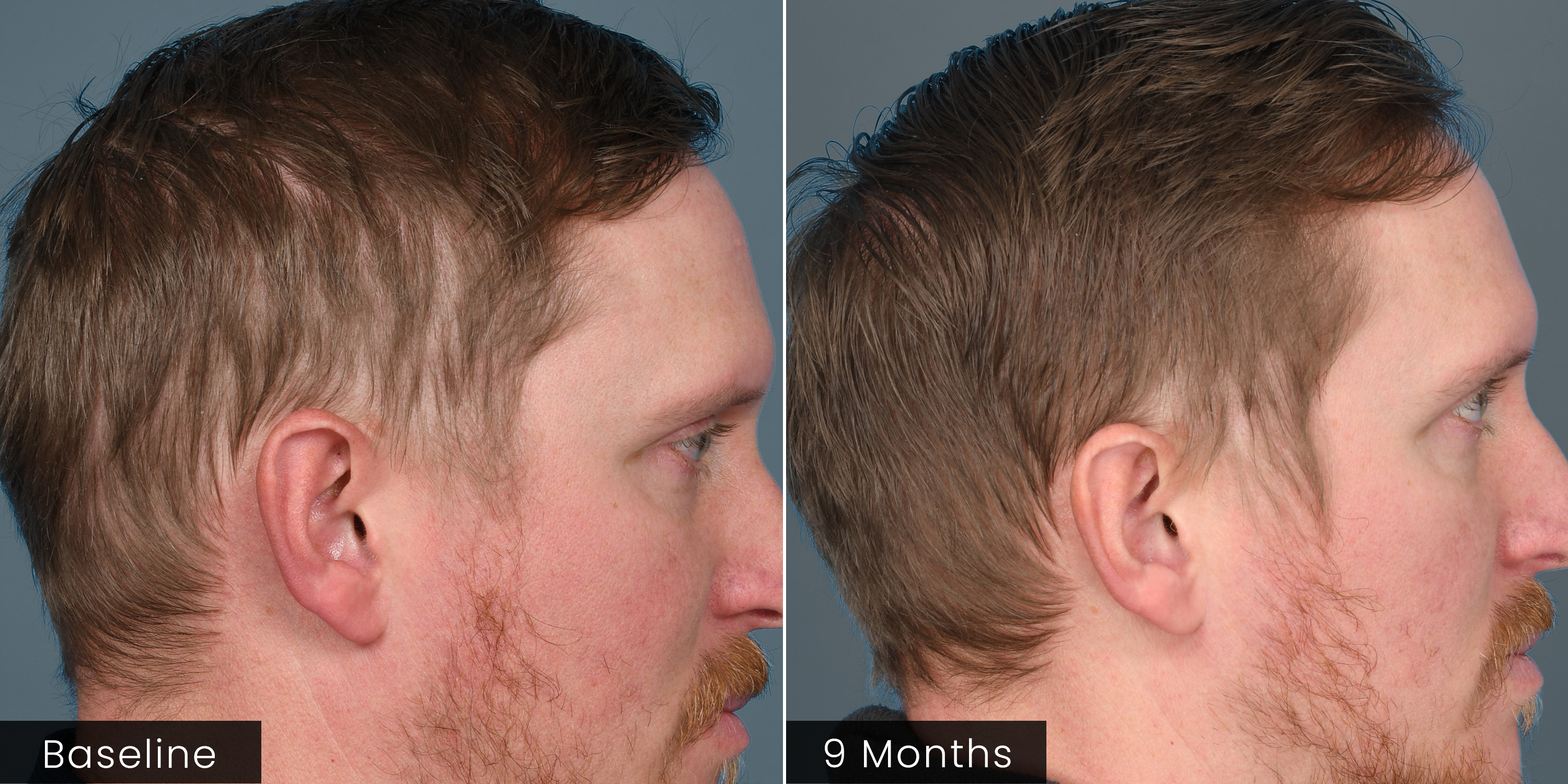 HAIR Serum by plated, view 10 of 12
