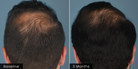 HAIR Serum by plated, view 11 of 12