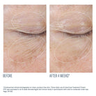 InterFuse Treatment Cream EYE before and after clinical photography