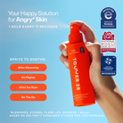 Benefits of SOS Rescue Spray: soothing, purifying, reduces redness, alcohol-free, fragrance-free, safe for sensitive skin