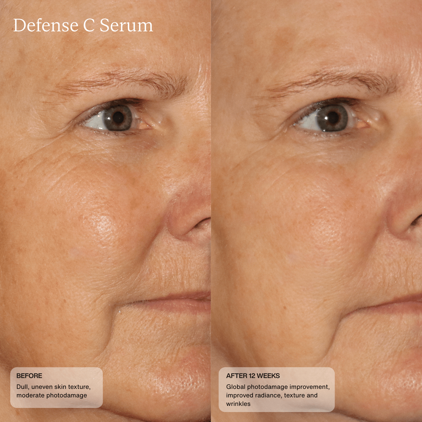 Defense C Serum by Senté, packaging