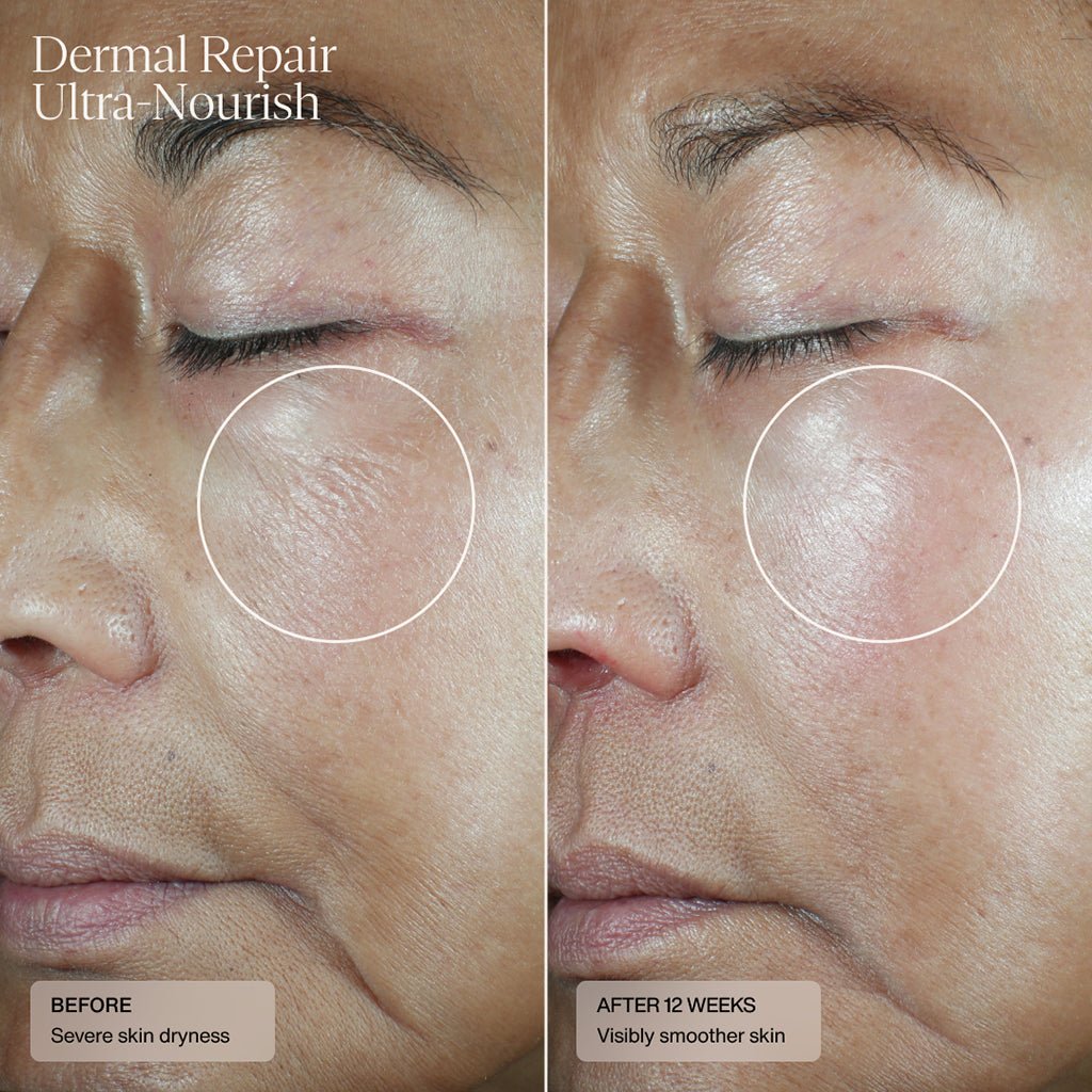 Dermal Repair Ultra-Nourish by Senté, detail