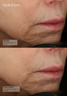 HydraFirm Serum by Senté, in use