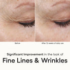 ( plated ) INTENSE Serum