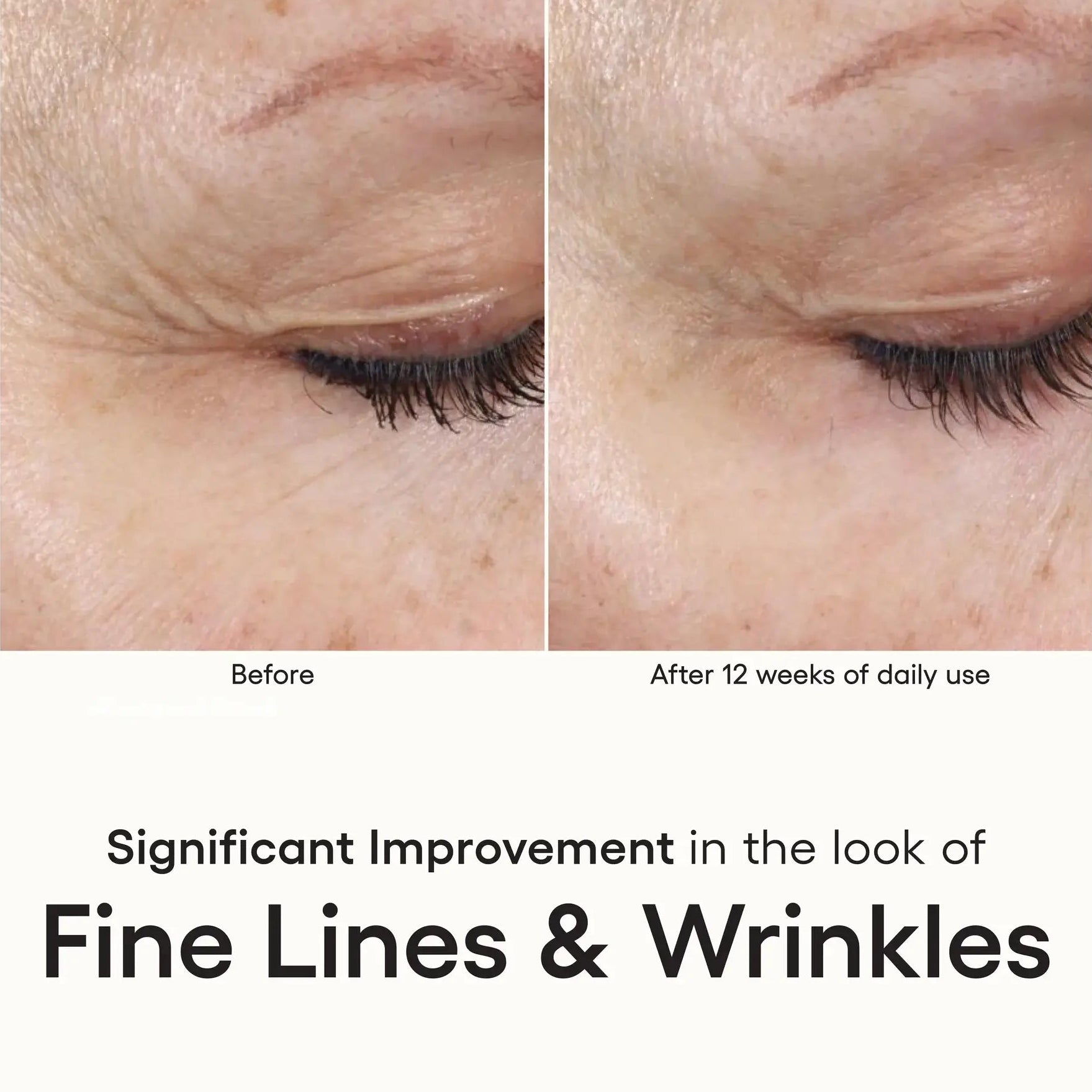 ( plated ) INTENSE Serum