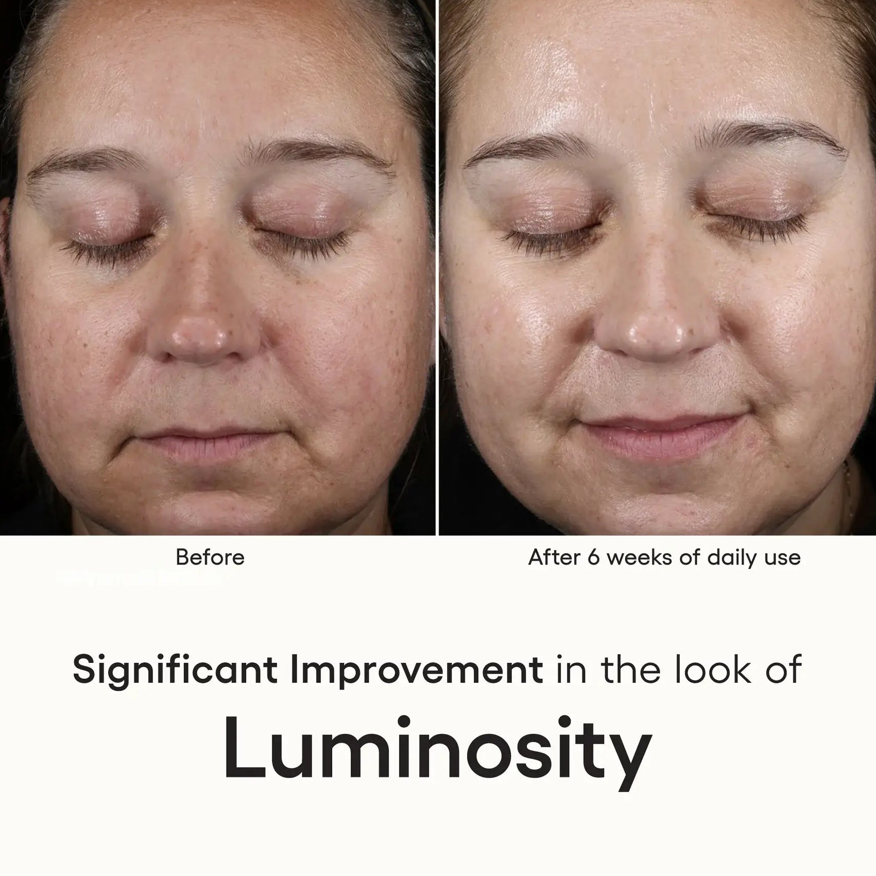 ( plated ) INTENSE Serum